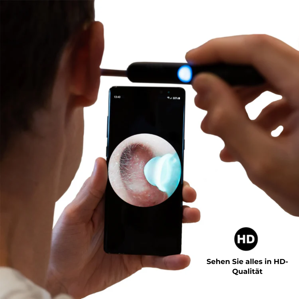 OhrVision™ – Smarte Ohrenreinigung mit sanfter und fortschrittlicher Technologie.