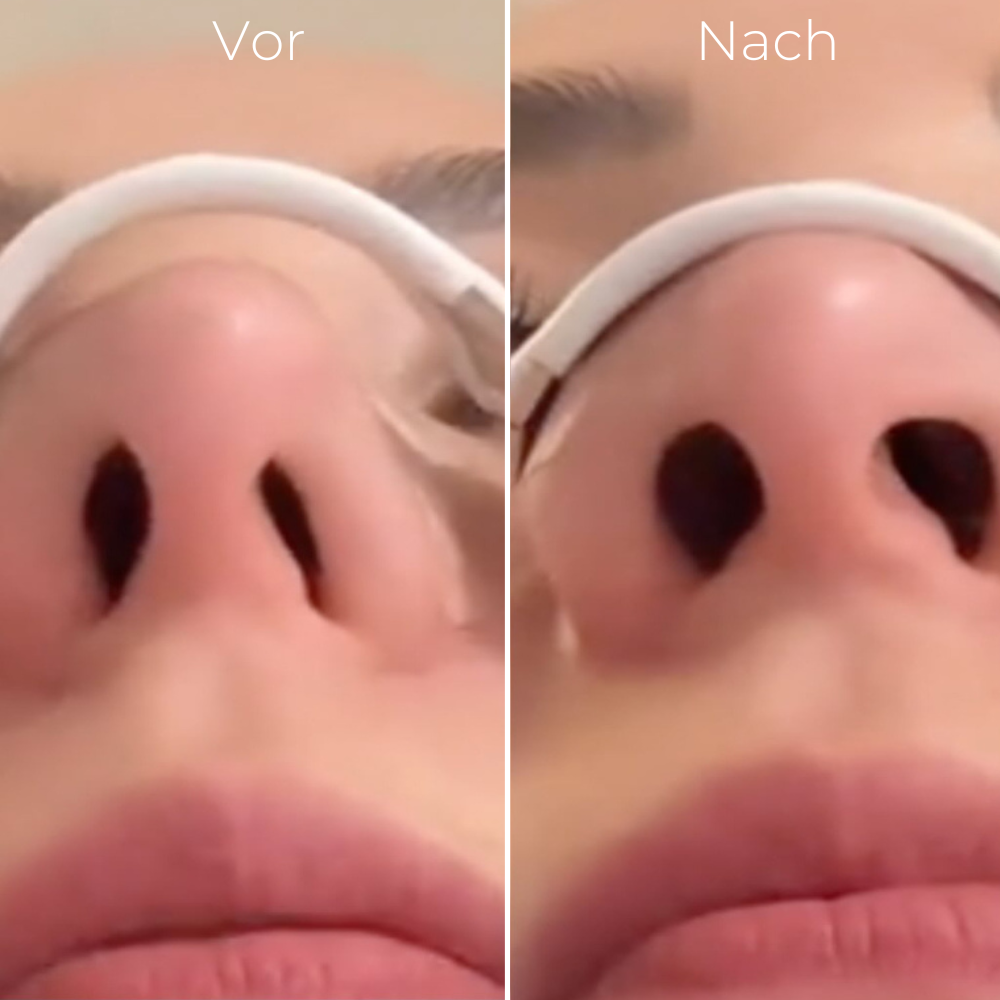 AeroFlow™ - Befreie deine Atmung, Entfessele deine Kraft!