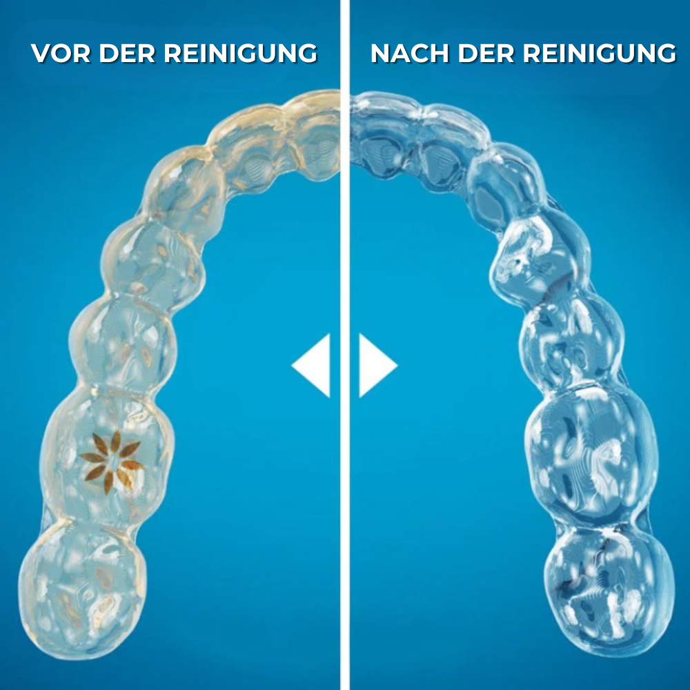 🦷 SonicPure™ – Deine tägliche Hygiene-Revolution für Aligner, Zahnspangen & Prothesen!