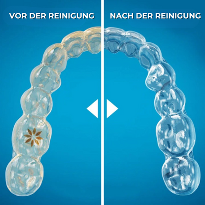 🦷 SonicPure™ – Deine tägliche Hygiene-Revolution für Aligner, Zahnspangen & Prothesen!